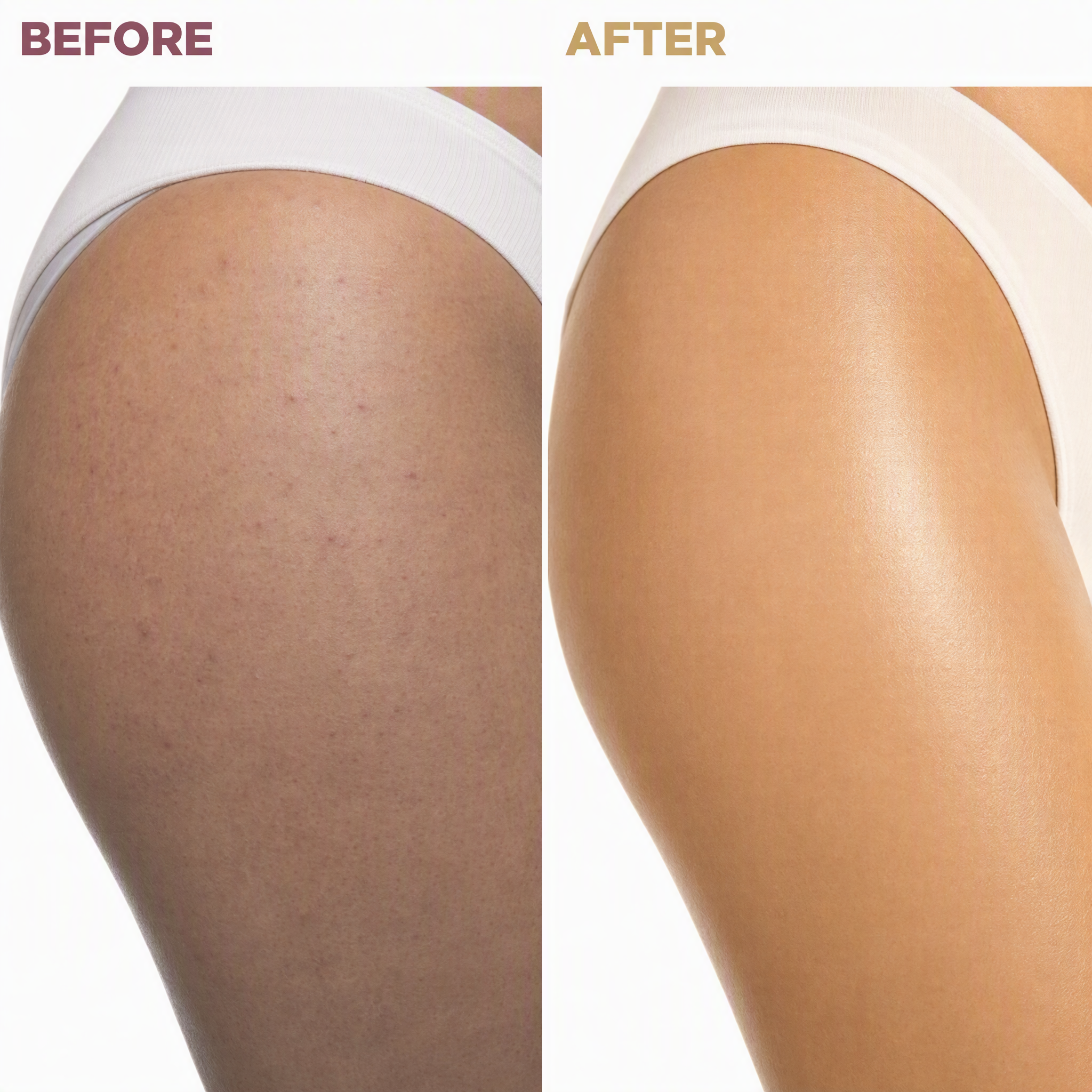 Anti-Acne Collagen Clay Mask