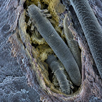 There are mites living in your pores and nobody told you